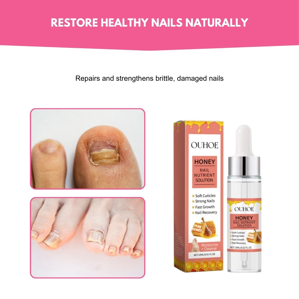 NailCurex® | Honey-Infused Care for Healthier Nails