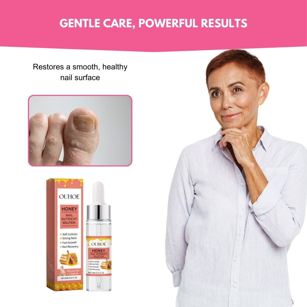 NailCurex® | Honey-Infused Care for Healthier Nails